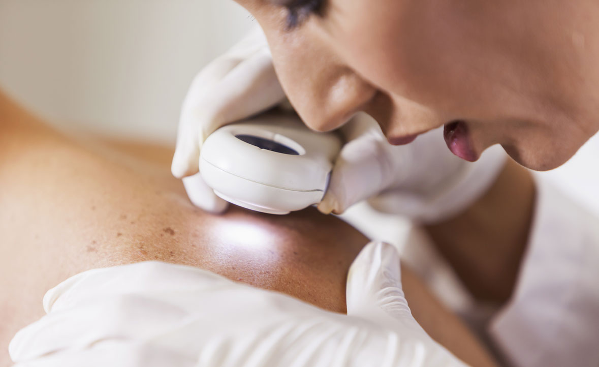 3 premissas da Riô que evitam reações adversas na pele