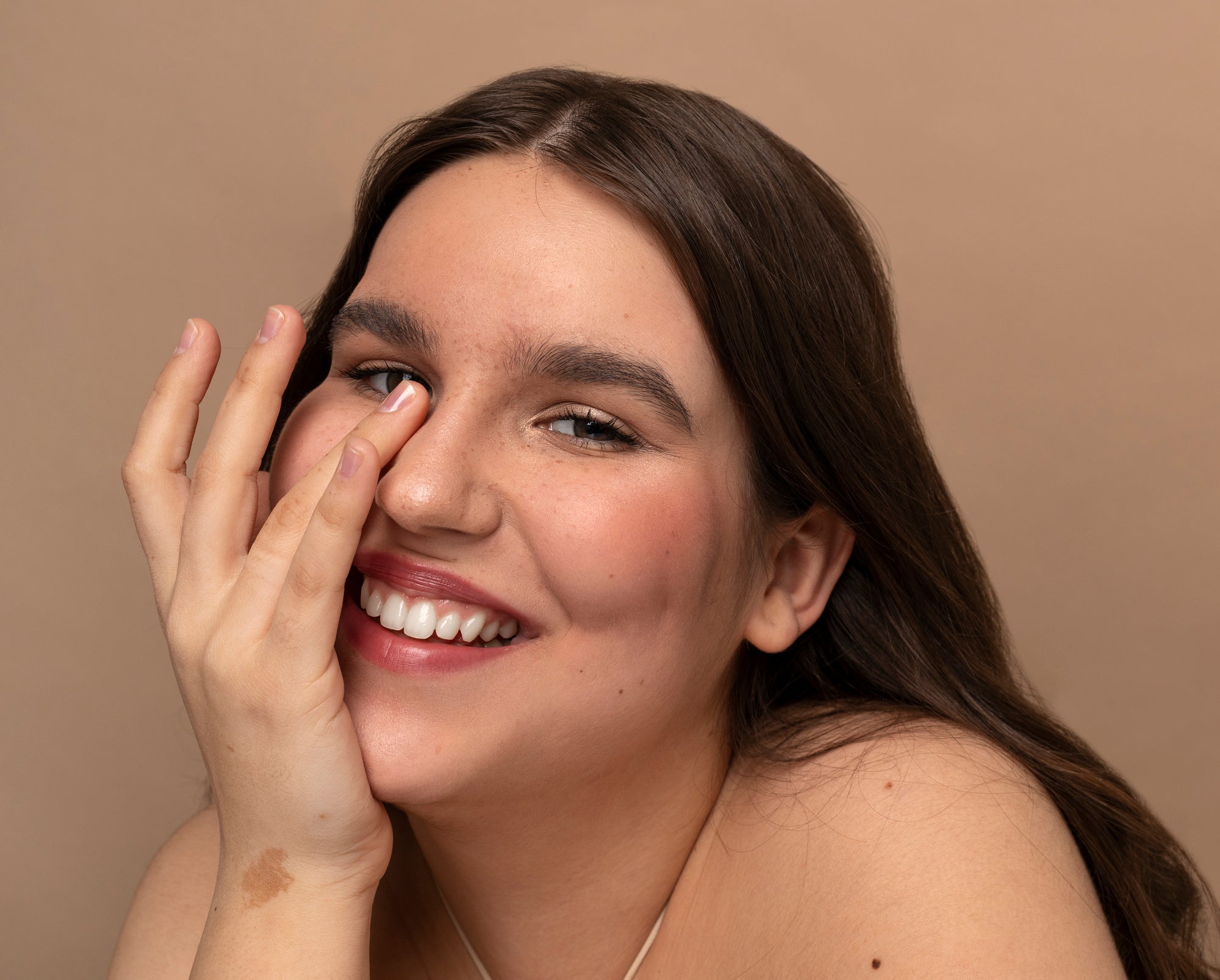 Jovem sorrindo com a mão apoiada no rosto, mostrando pele com sardas e uma mancha no braço, ilustrando artigo sobre tipos de melasma