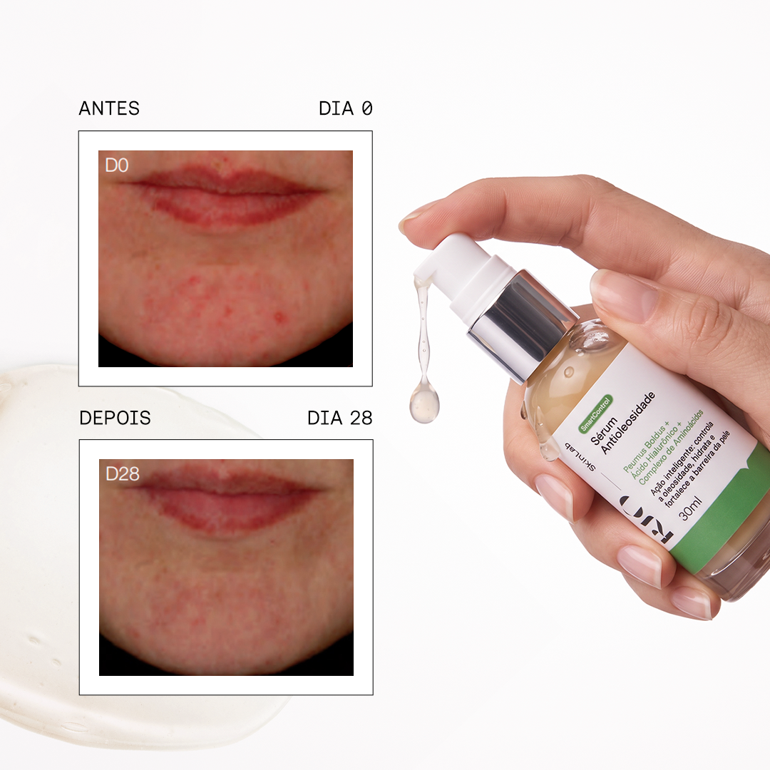 Sérum Antioleosidade Smart Control